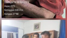 Seorang perempuan renta bernama Senti br. Silalahi, seorang petani warga Dusun Pangkalan Buttu, Nagori Tiga Bolon, Kecamatan Sidamanik menjadi korban penganiayaan brutal yang dilakukan oleh P.S.S, tetangganya sendiri yang diduga mengalami sakit jiwa.( Nawasenanews/ Ist)