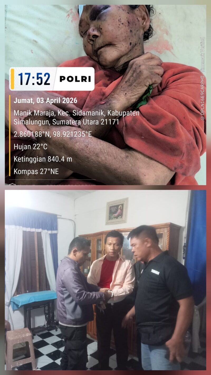 Seorang perempuan renta bernama Senti br. Silalahi, seorang petani warga Dusun Pangkalan Buttu, Nagori Tiga Bolon, Kecamatan Sidamanik menjadi korban penganiayaan brutal yang dilakukan oleh P.S.S, tetangganya sendiri yang diduga mengalami sakit jiwa.( Nawasenanews/ Ist)
